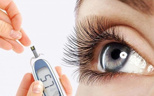 diyabetik-goz-hastaligi-nedir