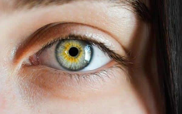 sari-nokta-hastaligi-nedir