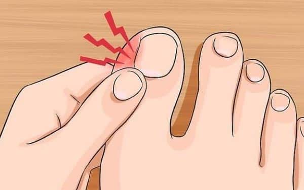 tirnak-batmasi-ihmale-gelmez